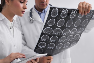 Photo of Doctors examining MRI images of patient with multiple sclerosis in clinic, closeup