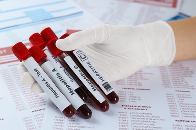 Scientist holding tubes with blood samples for hepatitis virus test against laboratory forms, closeup