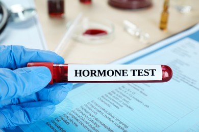 Photo of Hormones test. Scientist holding sample tube with blood against laboratory form at table, closeup