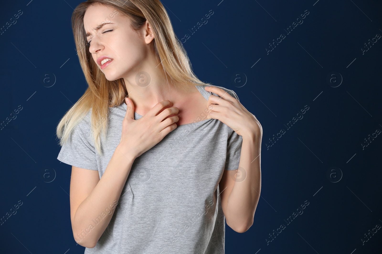 Photo of Portrait of woman scratching neck on color background, space for text. Allergy symptom