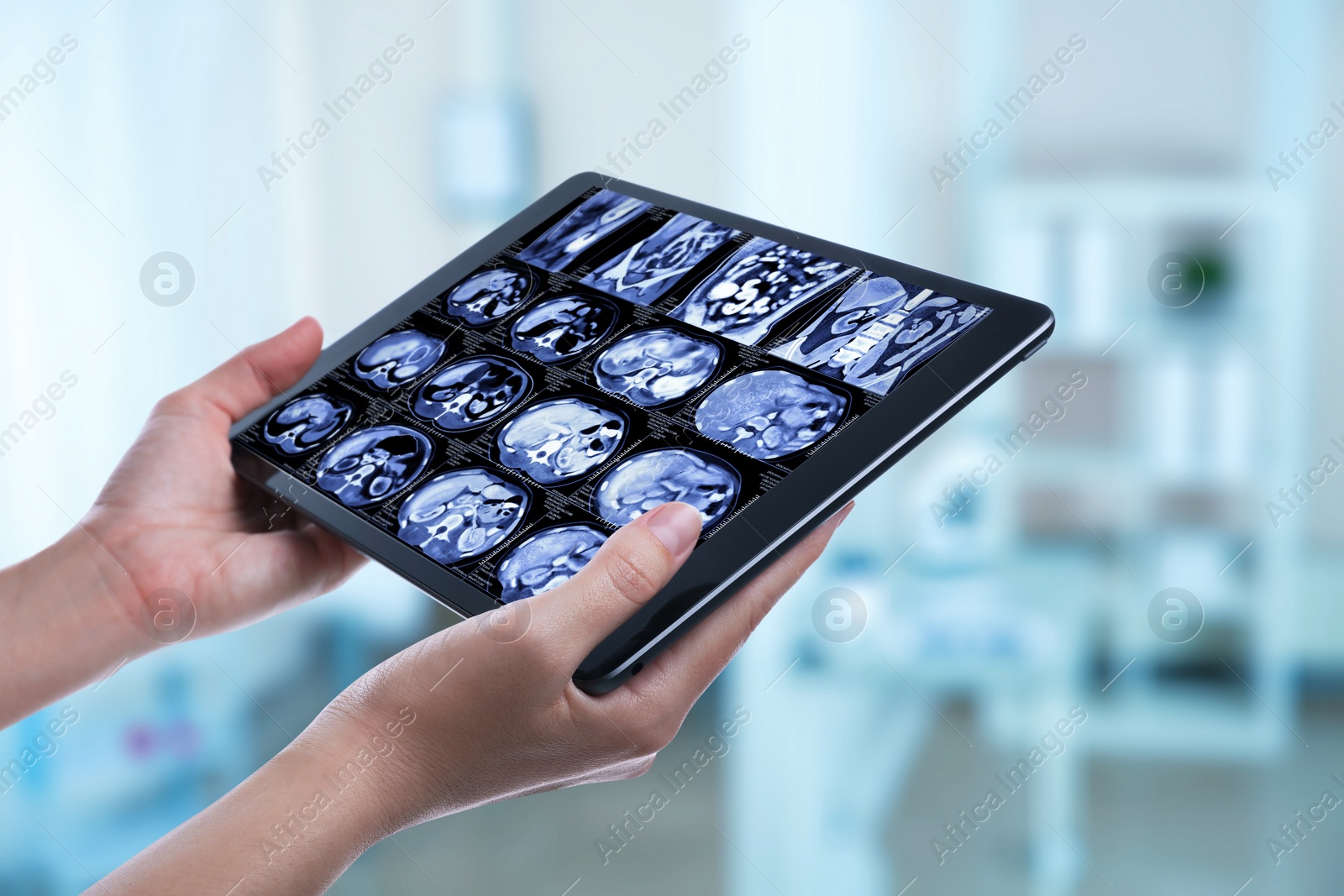 Image of Doctor examining x-ray images on tablet indoors, closeup