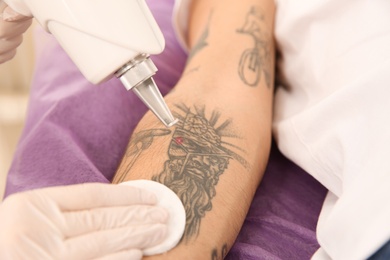 Photo of Young man undergoing laser tattoo removal procedure in salon, closeup