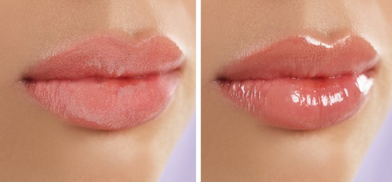 Image of Collage with photos of woman with dry and moisturized lips, closeup. Banner design