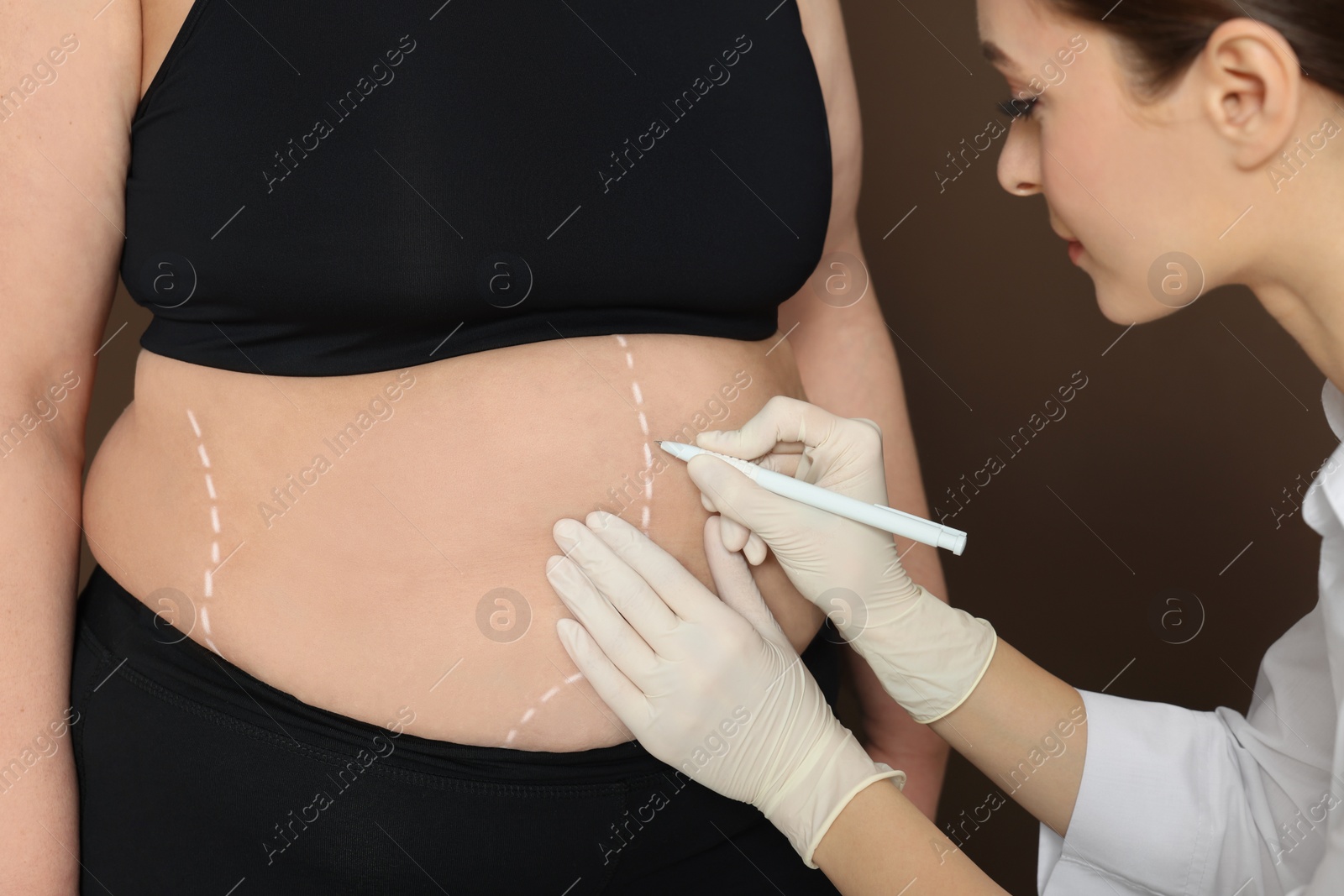 Photo of Doctor drawing marks on obese woman's body against brown background, closeup. Weight loss surgery