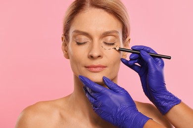 Photo of Doctor with pencil preparing patient for cosmetic surgery operation on pink background, closeup