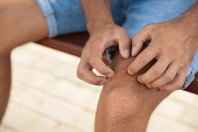 Photo of Man scratching leg with insect bites on bench outdoors, closeup