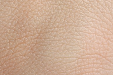 Texture of healthy skin as background, macro view