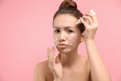 Photo of Teen girl with acne problem applying cream on light pink background