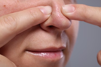 Photo of Woman popping pimple on her nose against grey background, closeup