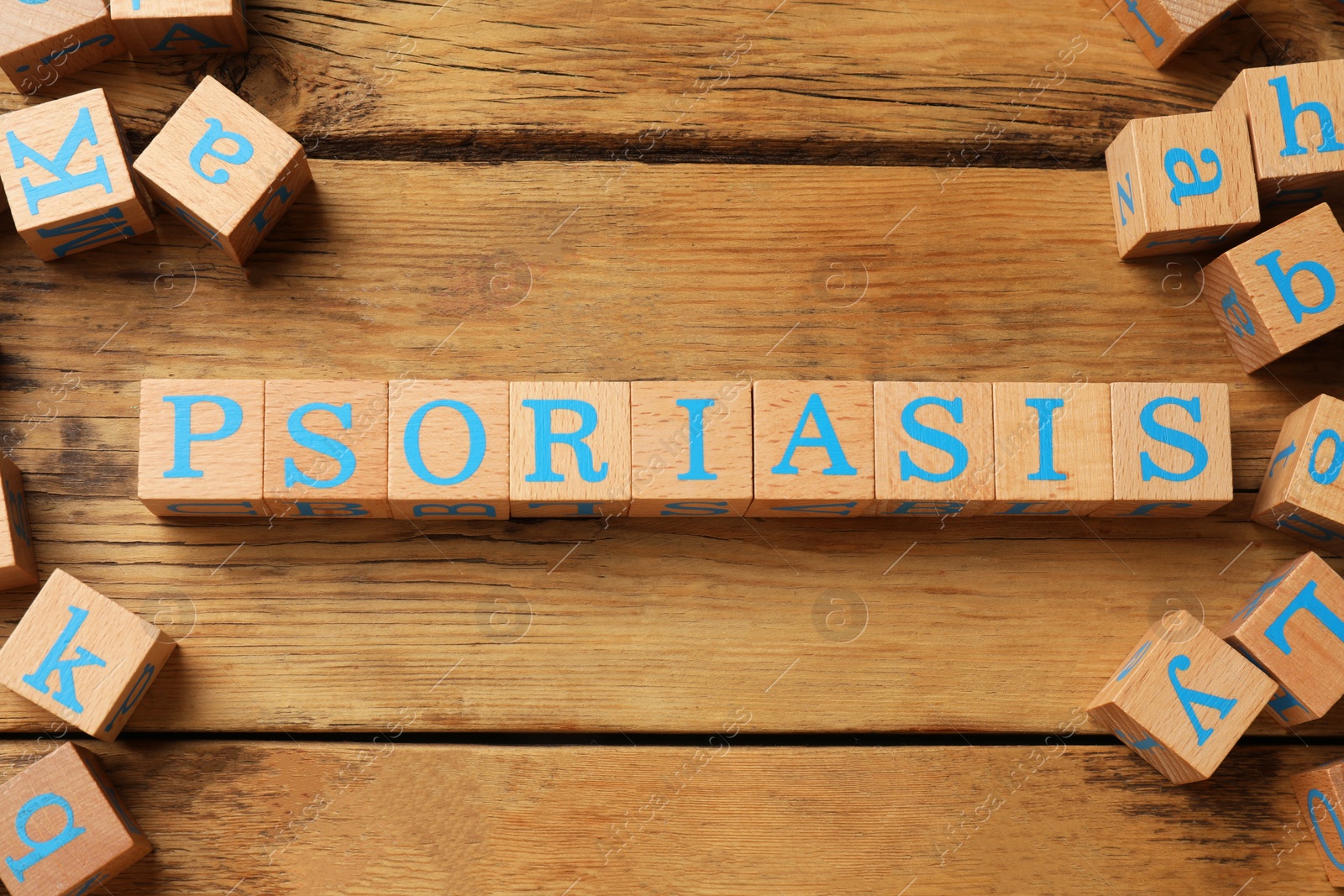 Photo of Word Psoriasis made of cubes with letters on wooden table, flat lay