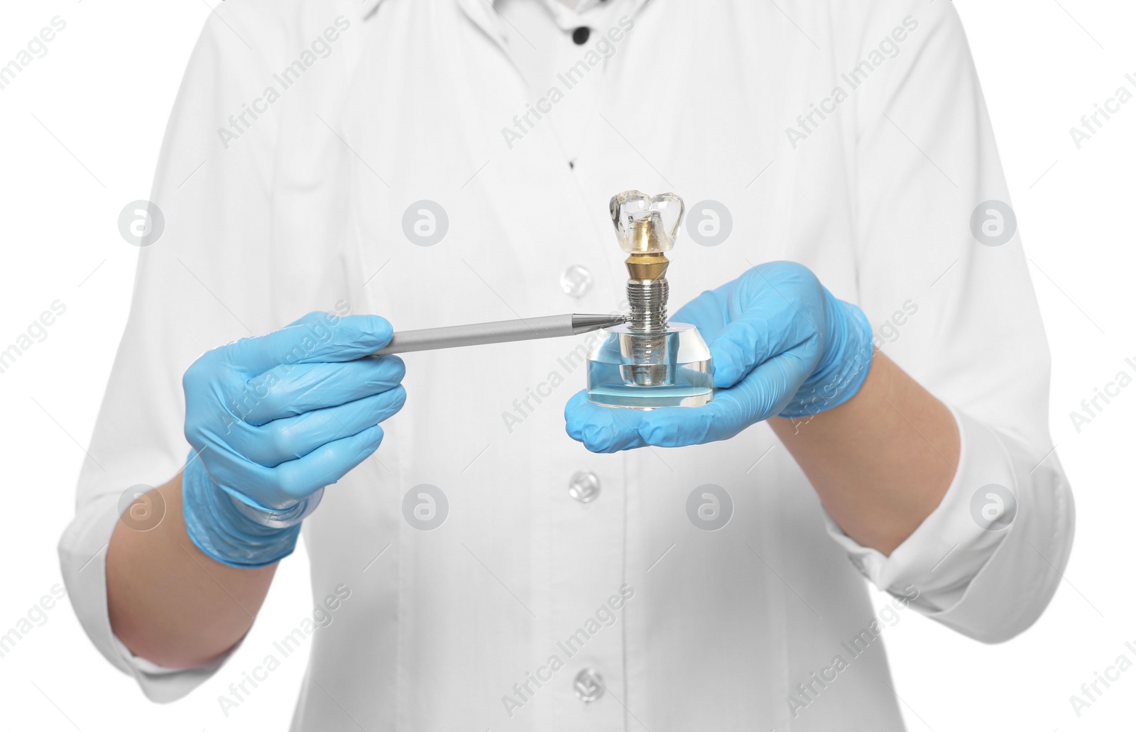 Photo of Dentist holding educational model of dental implant on white background, closeup