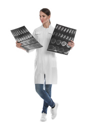 Photo of Orthopedist holding X-ray pictures on white background