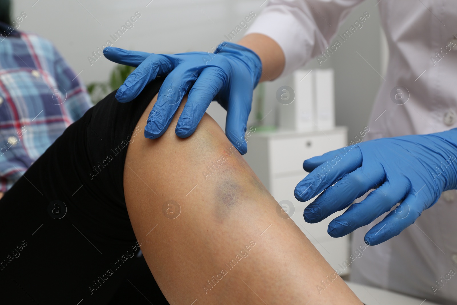 Photo of Doctor checking boy's leg with bruise at hospital, closeup