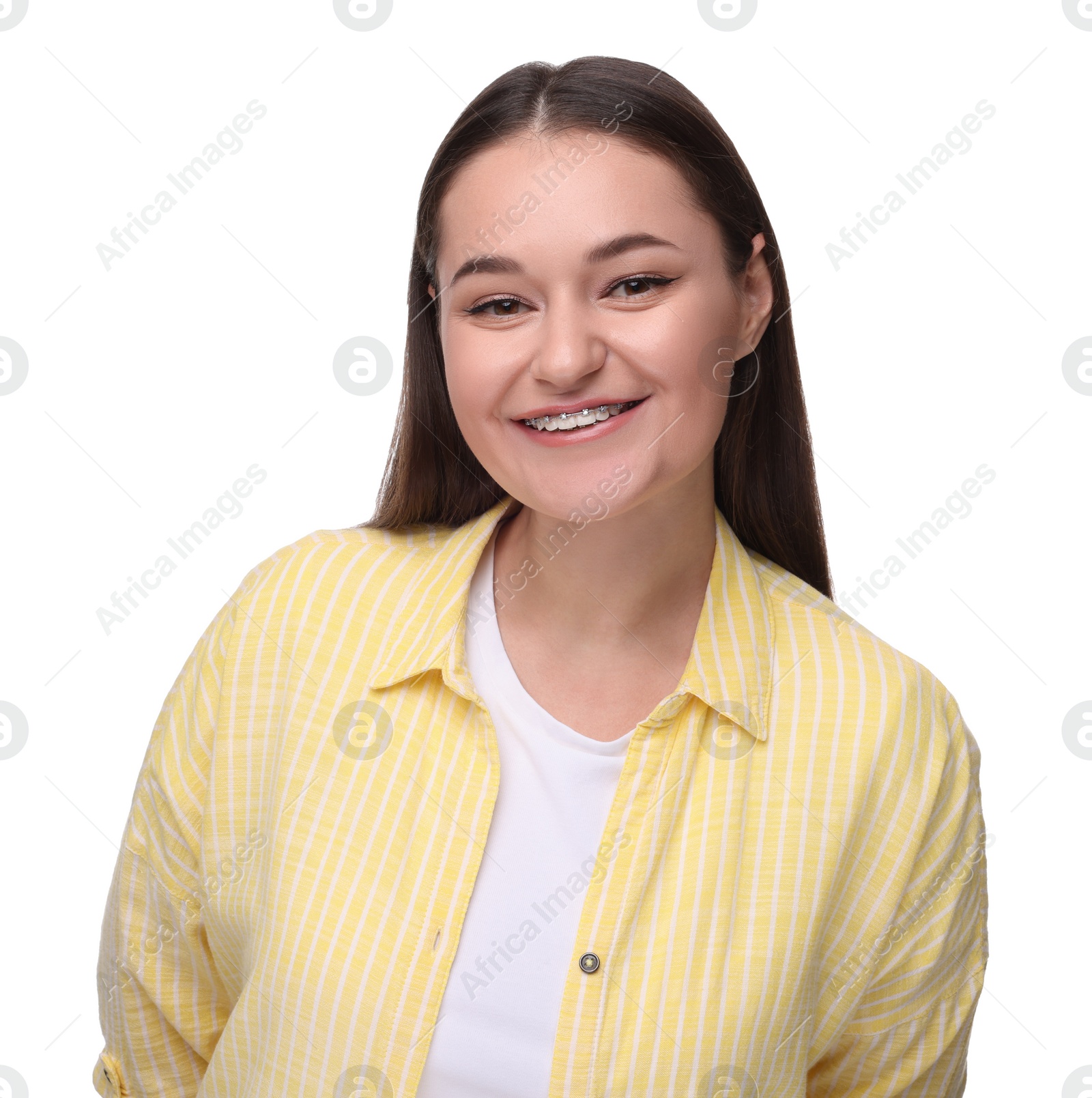 Photo of Smiling woman with dental braces on white background