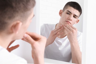 Photo of Young man looking at mirror and touching pimple on his face indoors. Acne problem