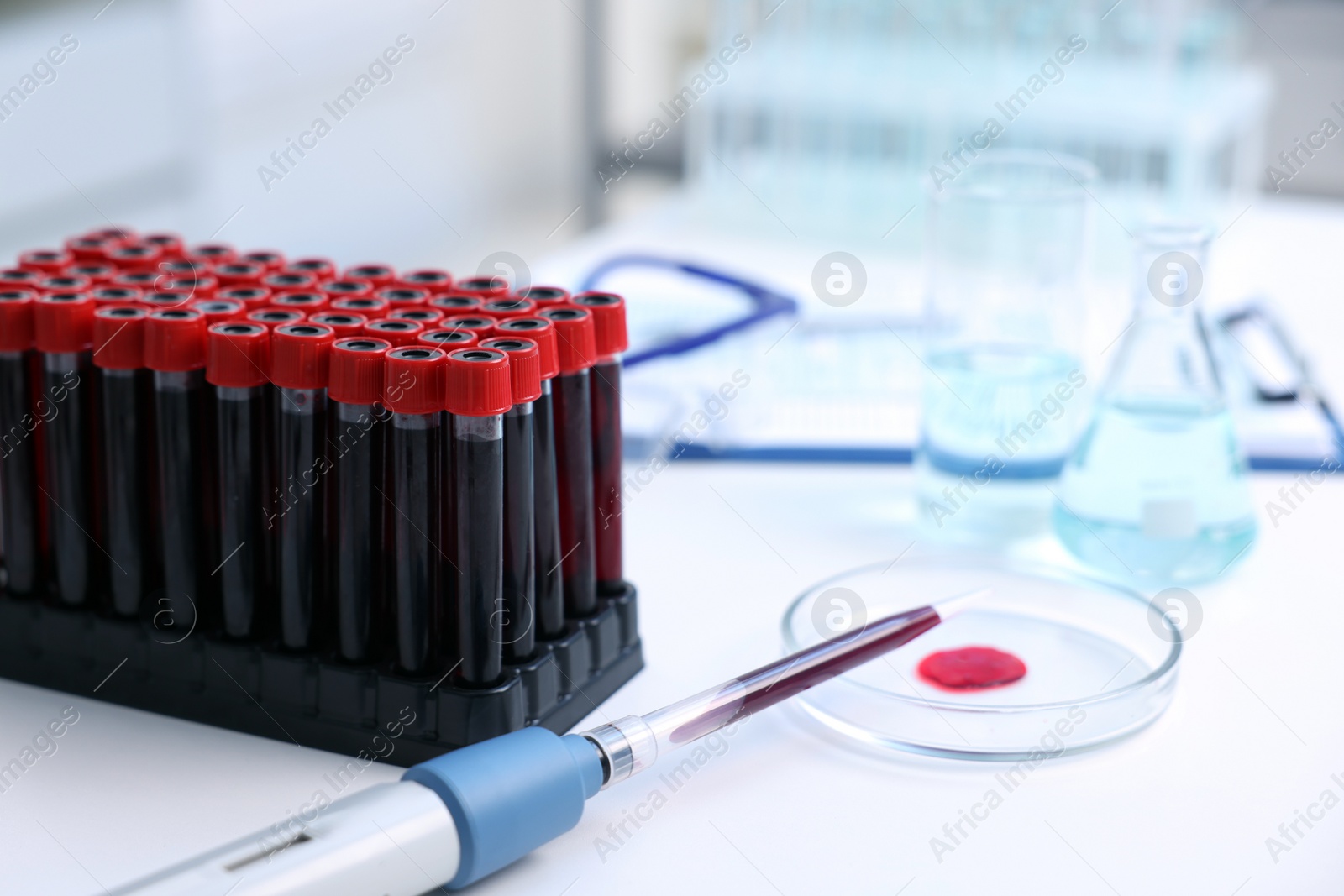 Photo of Dripping blood sample onto Petri dish on white table in laboratory, closeup