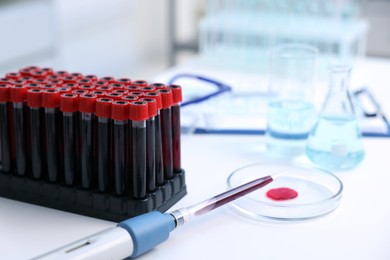 Photo of Dripping blood sample onto Petri dish on white table in laboratory, closeup