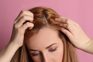 Woman suffering from baldness on pink background, closeup
