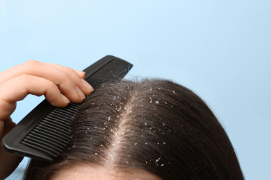 Image of Woman with comb and dandruff in her dark hair on color background, closeup