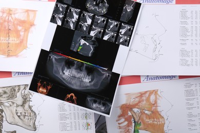 Panoramic x-ray and dental anatomy charts as background, top view