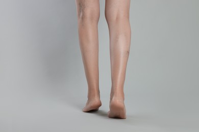 Photo of Closeup view of woman with varicose veins on light grey background