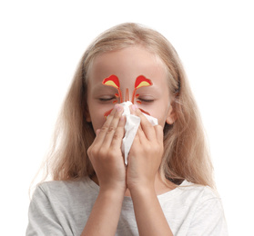 Little girl suffering from runny nose as allergy symptom. Sinuses illustration on face