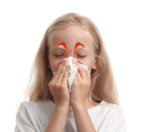 Image of Little girl suffering from runny nose as allergy symptom. Sinuses illustration on face