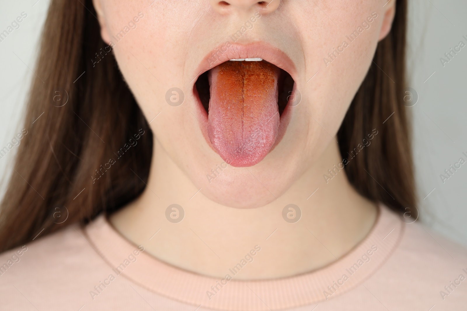 Photo of Gastrointestinal diseases. Woman showing her yellow tongue on light grey background, closeup