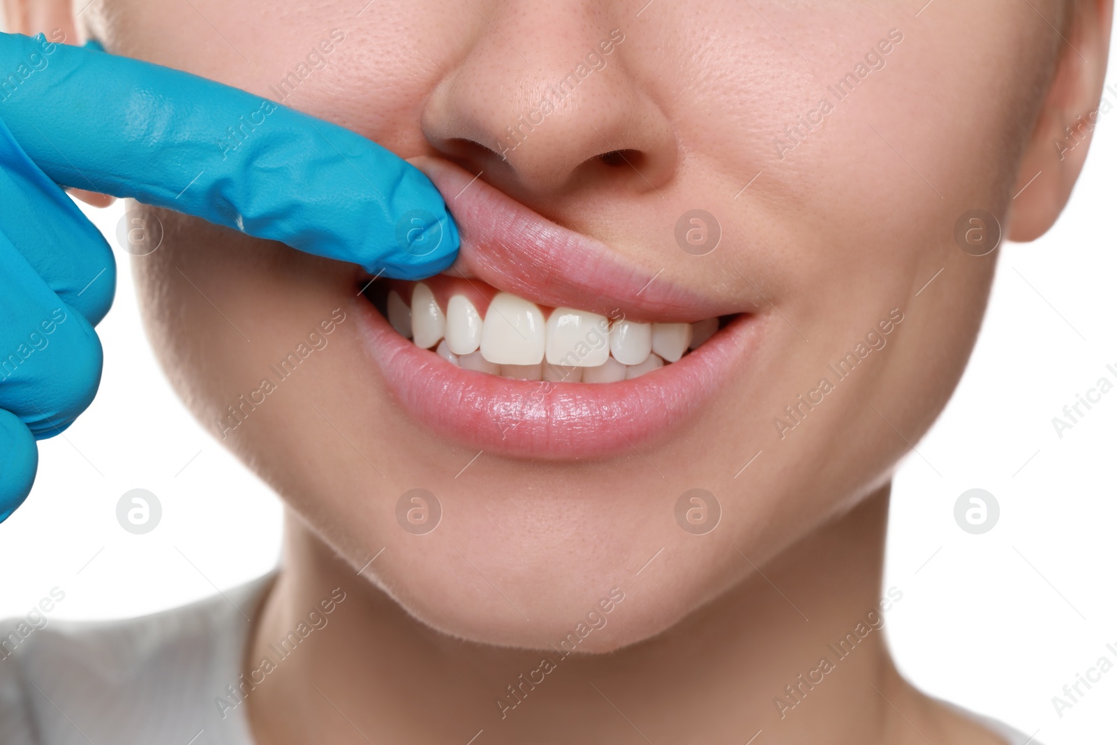 Photo of Doctor examining woman's gums on white background, closeup
