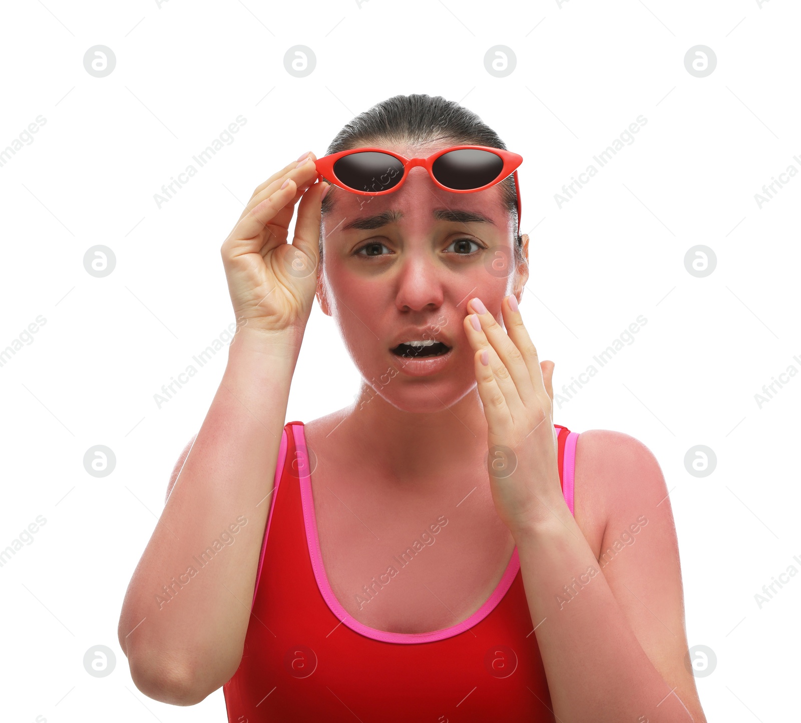 Photo of Woman with sunburned skin on white background