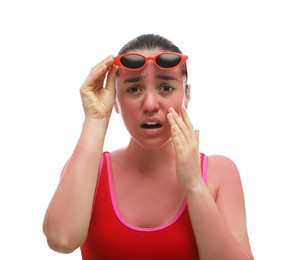 Woman with sunburned skin on white background