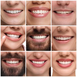People showing white teeth, closeup. Collage of photos