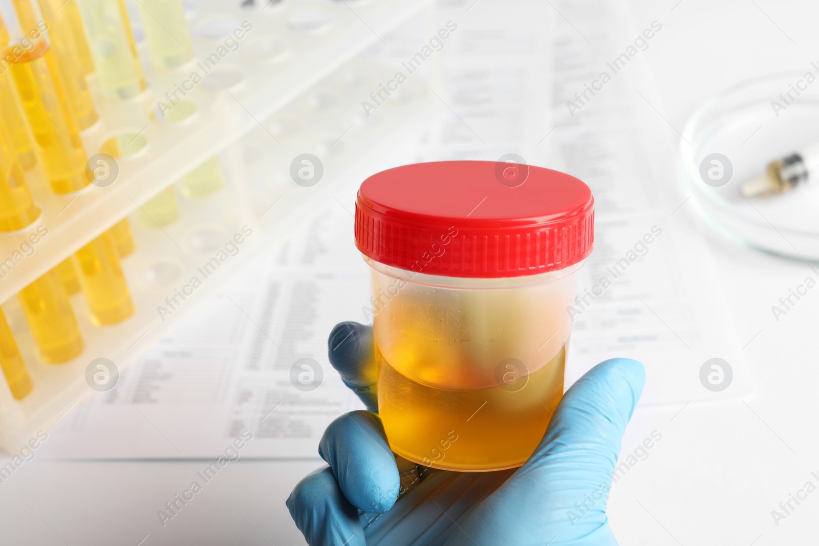 Photo of Nurse holding container with urine sample for analysis at table, closeup
