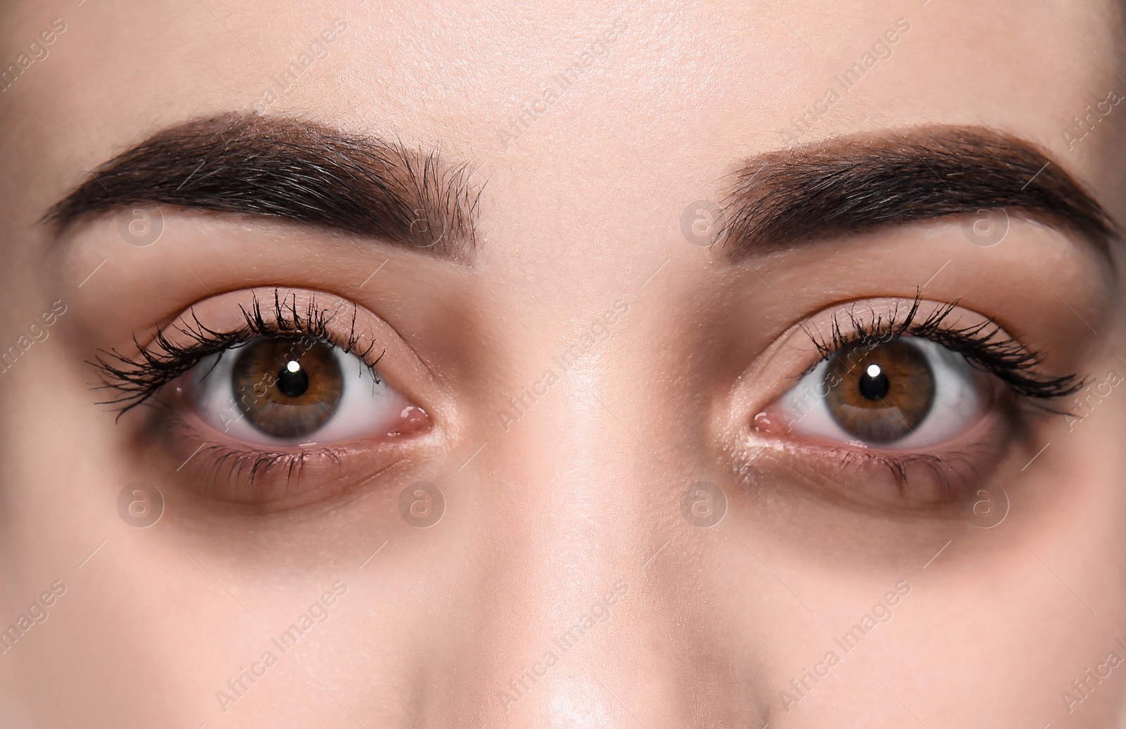 Image of Tired young woman with dark circles under eyes, closeup