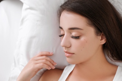 Young woman with eyelash loss problem sleeping in bed