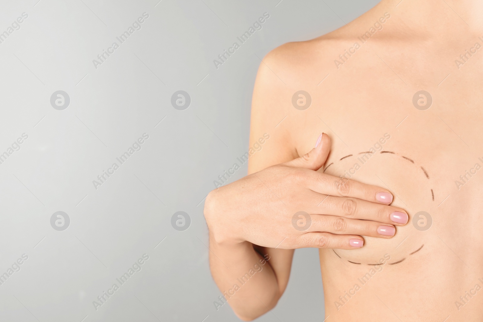 Photo of Young woman with marks on breast for cosmetic surgery operation against gray background, closeup. Space for text