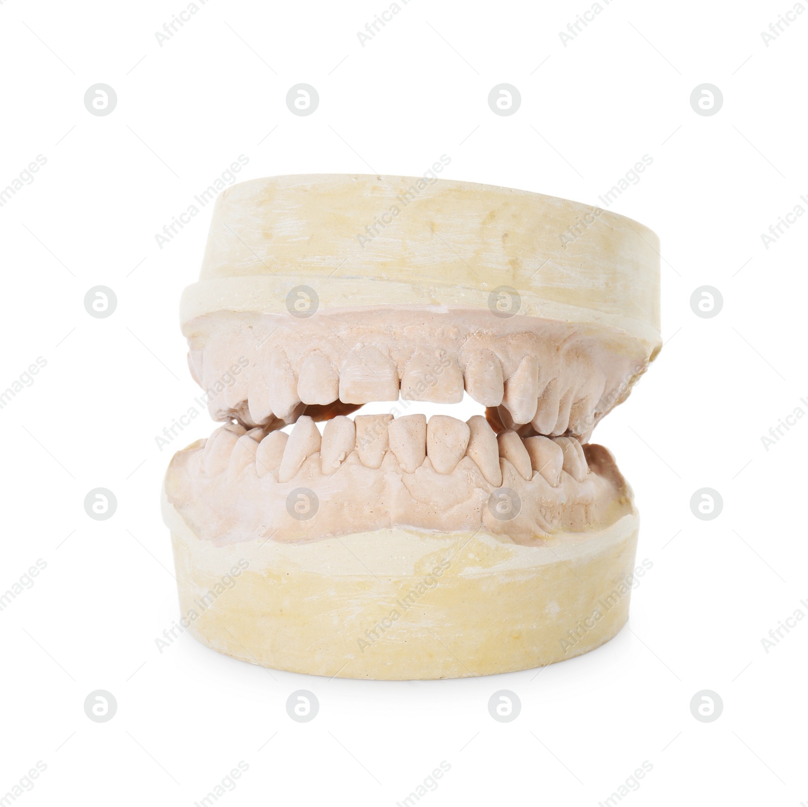 Photo of Dental model with jaws isolated on white. Cast of teeth