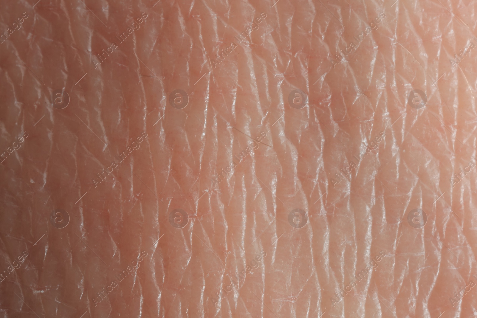 Photo of Texture of dry skin as background, macro view