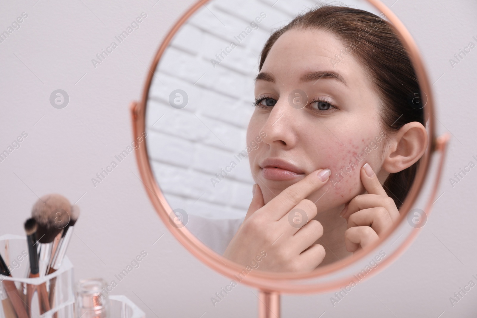 Photo of Woman with acne problem looking at mirror indoors