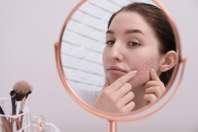 Woman with acne problem looking at mirror indoors
