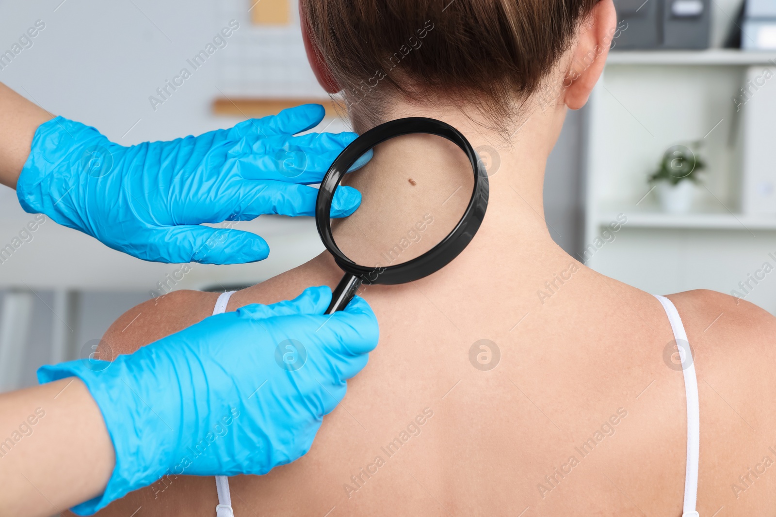 Photo of Dermatologist examining patient's birthmark with magnifying glass in clinic, closeup