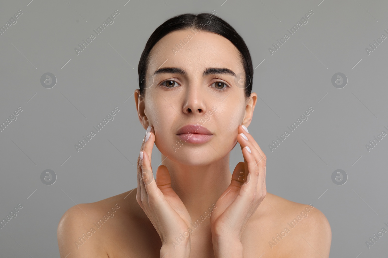 Photo of Young woman with dry skin on gray background