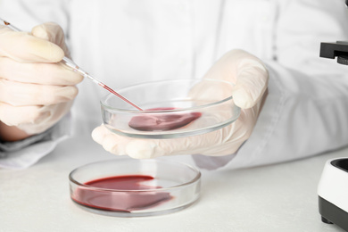 Photo of Scientist taking blood sample from Petri dish with pipette in laboratory, closeup. Virus research