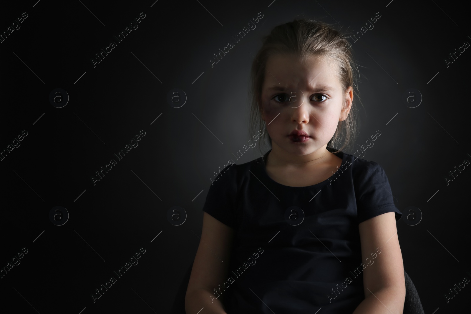 Photo of Little girl with bruises on face against dark background, space for text. Domestic violence victim