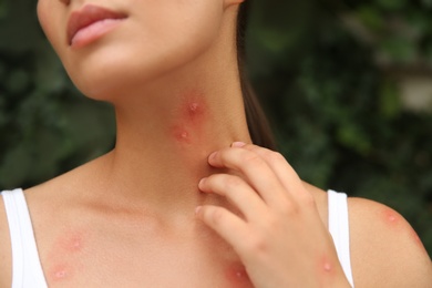 Photo of Woman scratching neck with insect bites outdoors, closeup