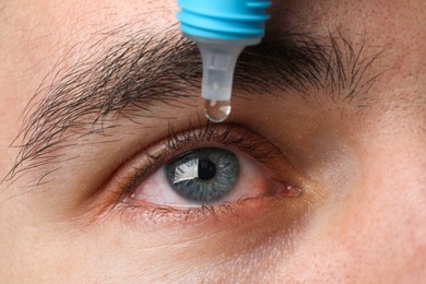Man with conjunctivitis using eye drops, closeup