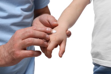 Photo of Father applying ointment onto his daughter's hand against white background, closeup