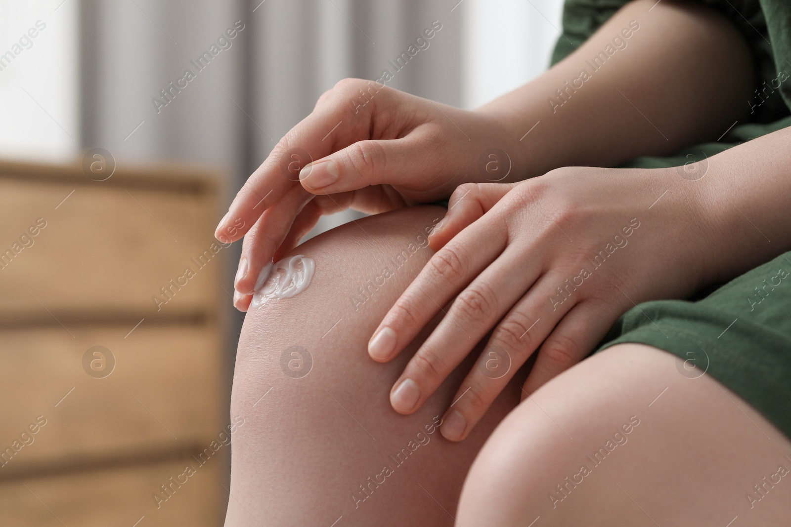Photo of Woman applying ointment onto her knee indoors, closeup