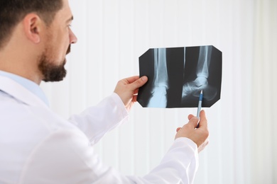 Photo of Professional orthopedist examining X-ray picture in his office, focus on hands