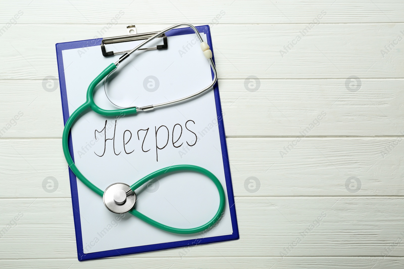 Photo of Clipboard with word Herpes and stethoscope on white wooden table, top view. Space for text